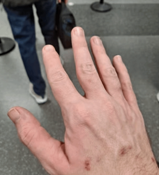 Mew2King因疑似床虱问题被XFS赛事禁止参赛